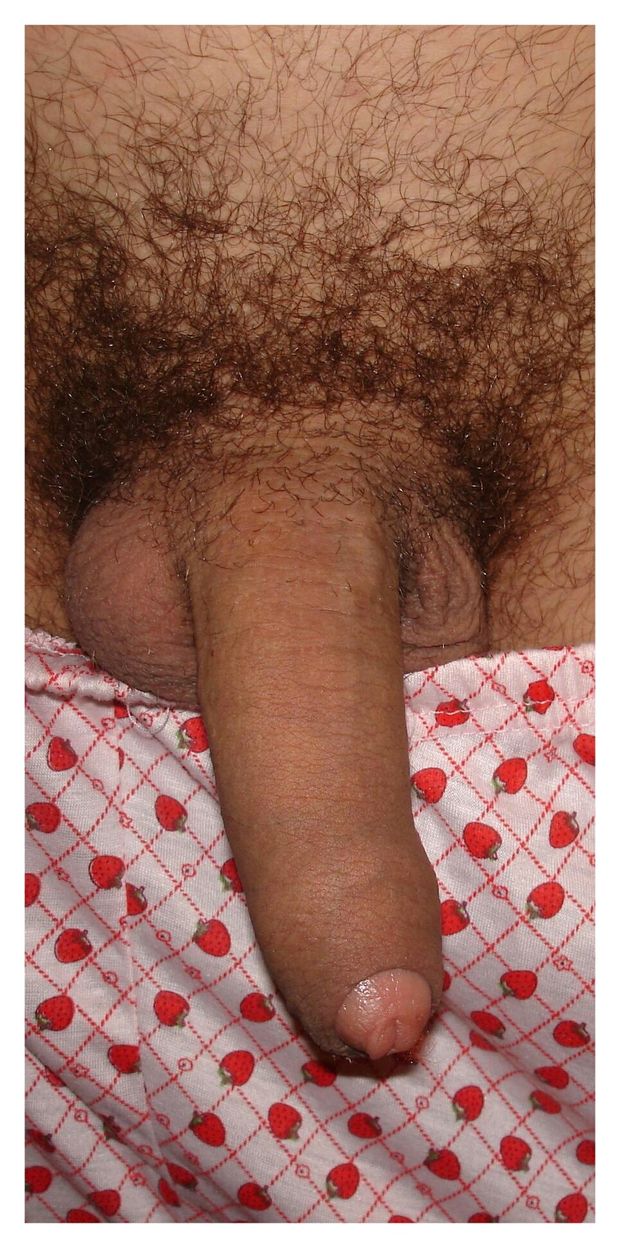 Penis