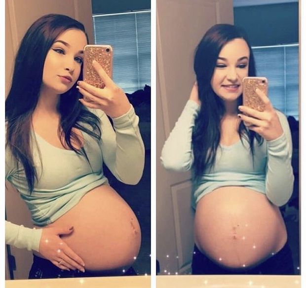 pregnant