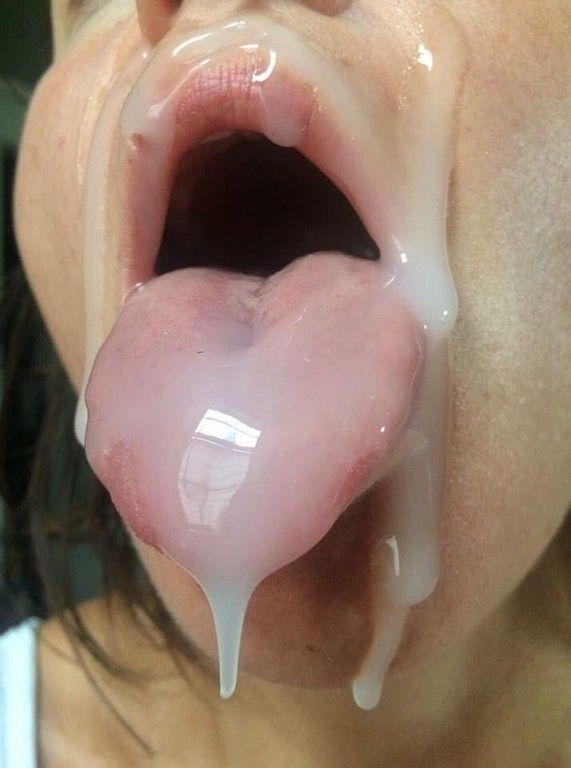 Glazed