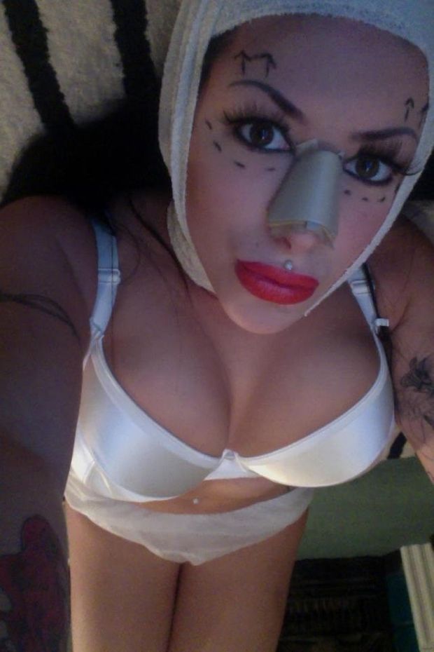 Micky Syndrome had some odd surgerized to make her look like her hero Cher the singist - fota weirdd