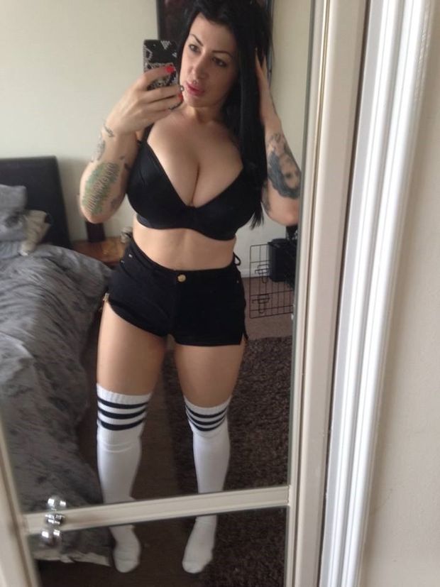 Micky Syndrome is a yung lady