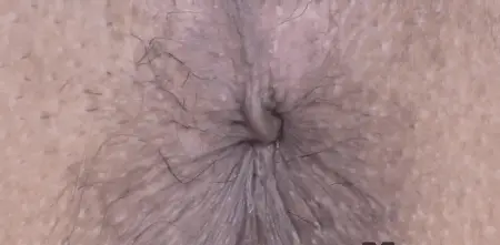 Hairy asshole