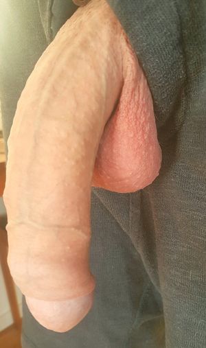 Just my uncut cock hanging out to dry