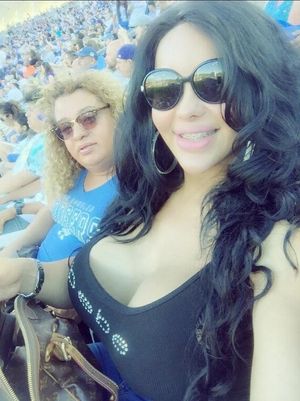 Bailey Slade can be seen w/ braces in public at the base ball games where The Bears vurses the New York Lakers - SGB bracesss