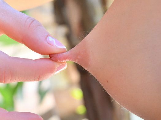 Puffy teen nipple