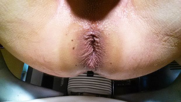 Me stretched by 3" plug