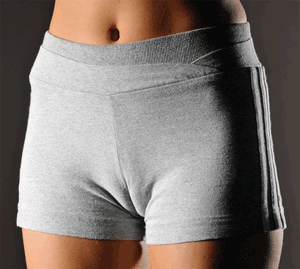 before and after cameltoe