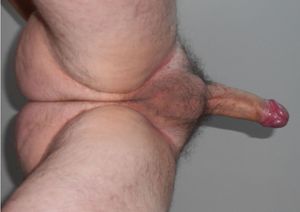 Down view erect penis