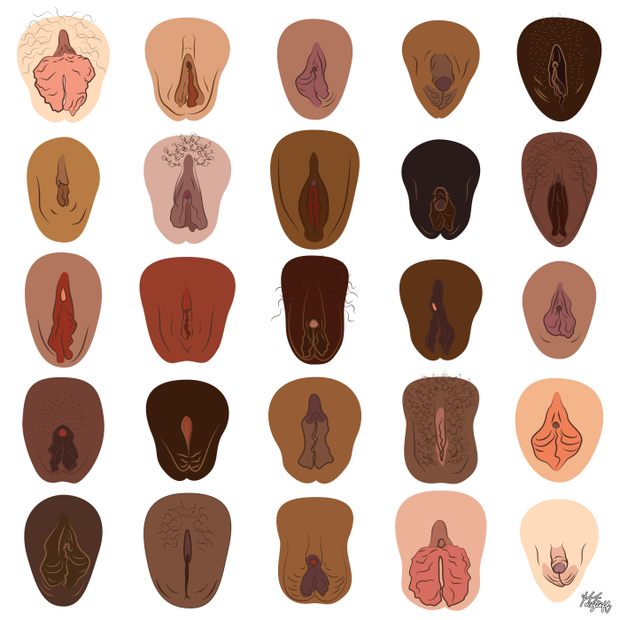 Various types of the vulva.