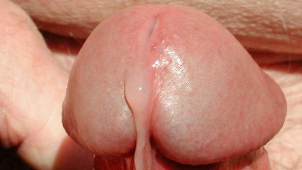 Head sperm