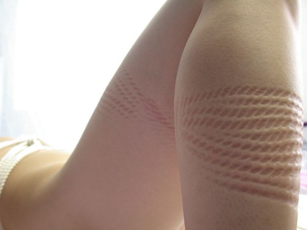 i love those marks