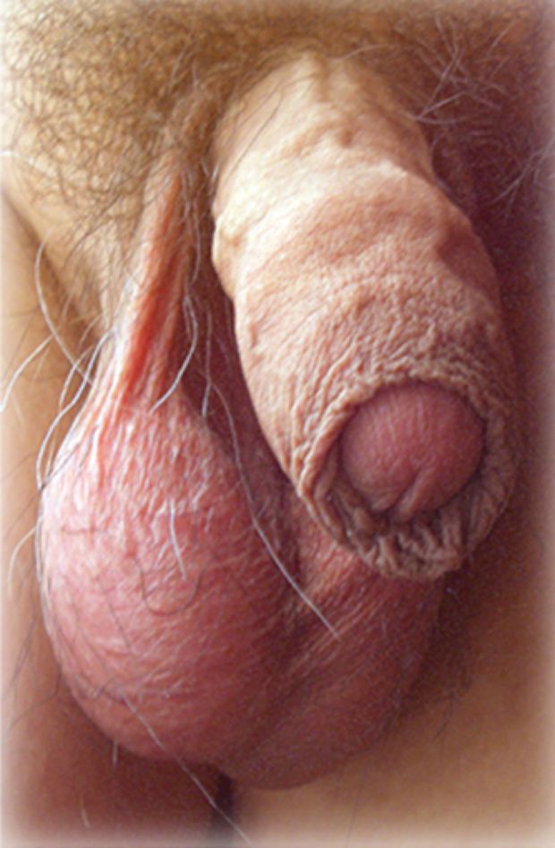 My sleepy dick