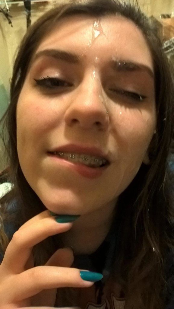 Bite lips