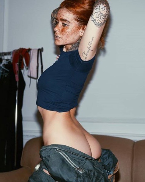 Amazing Freckles