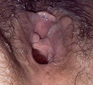 A little cream on the hole