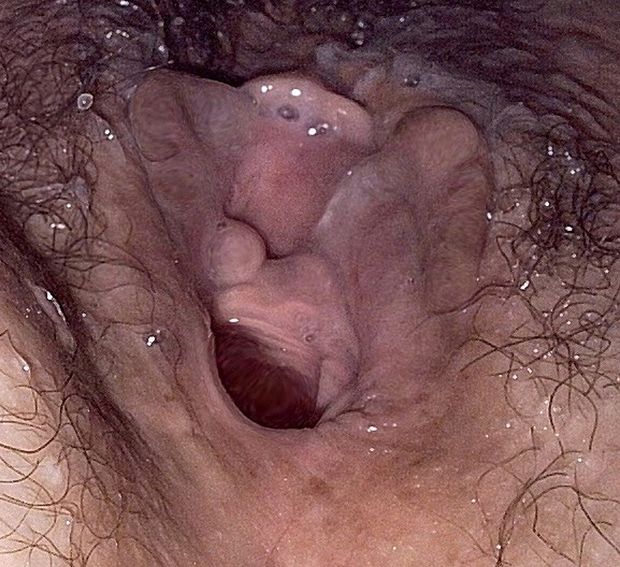 A little cream on the hole