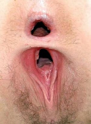 2 holes are better than 1