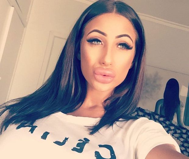 lips