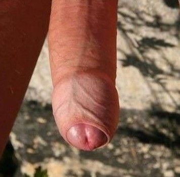 Foreskinned