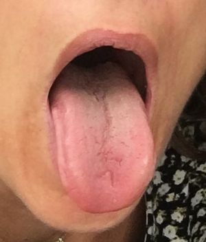 Delphinesensual Picture