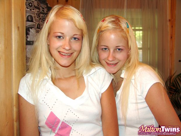 Milton Twins - Braces