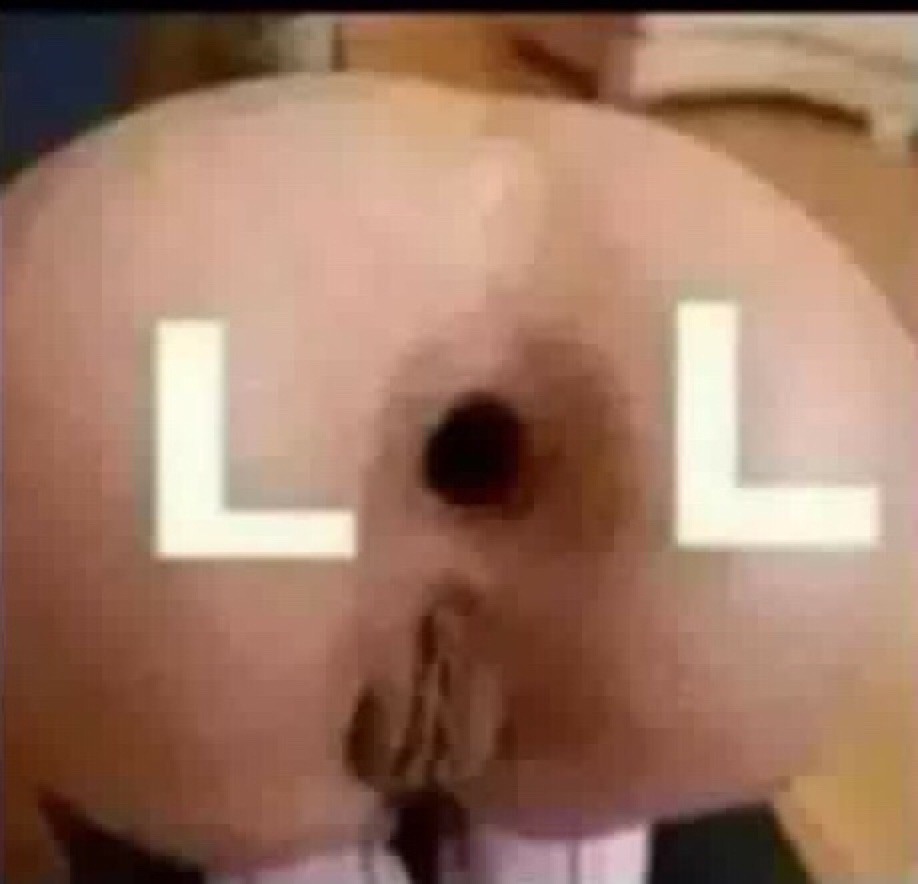 lol