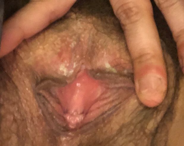 Hairy