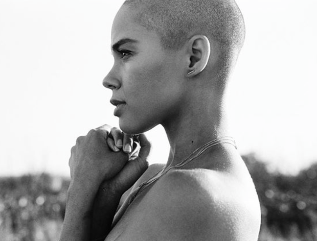 bald woman