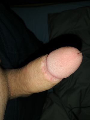 Axismus Picture