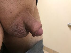 My tiny penis