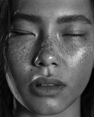 asian with freckles