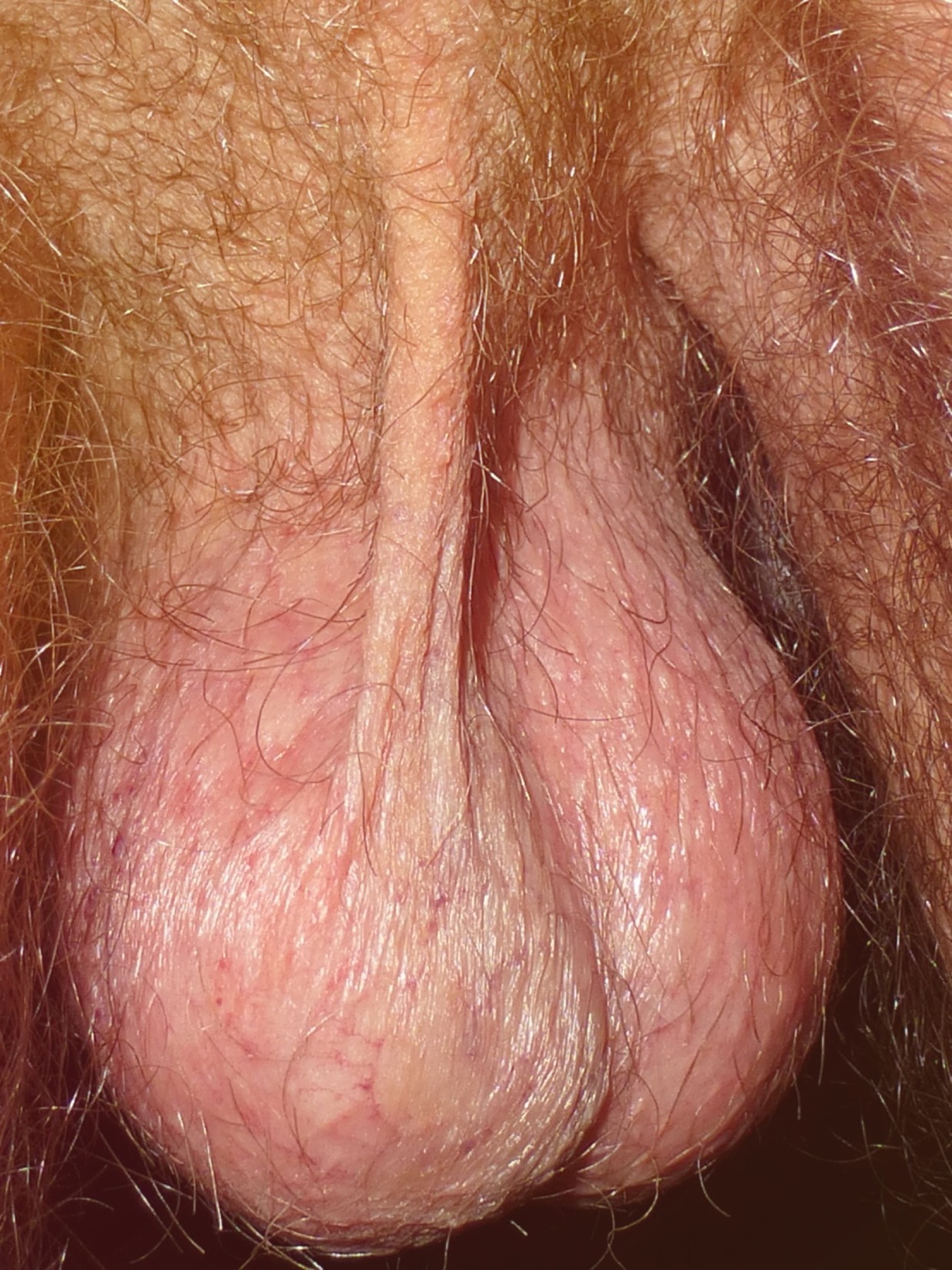 Some balls, if you please..