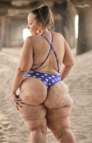 Big Cellulite Culo - Yummy