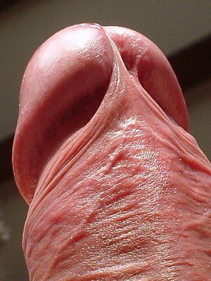 Splendid head..