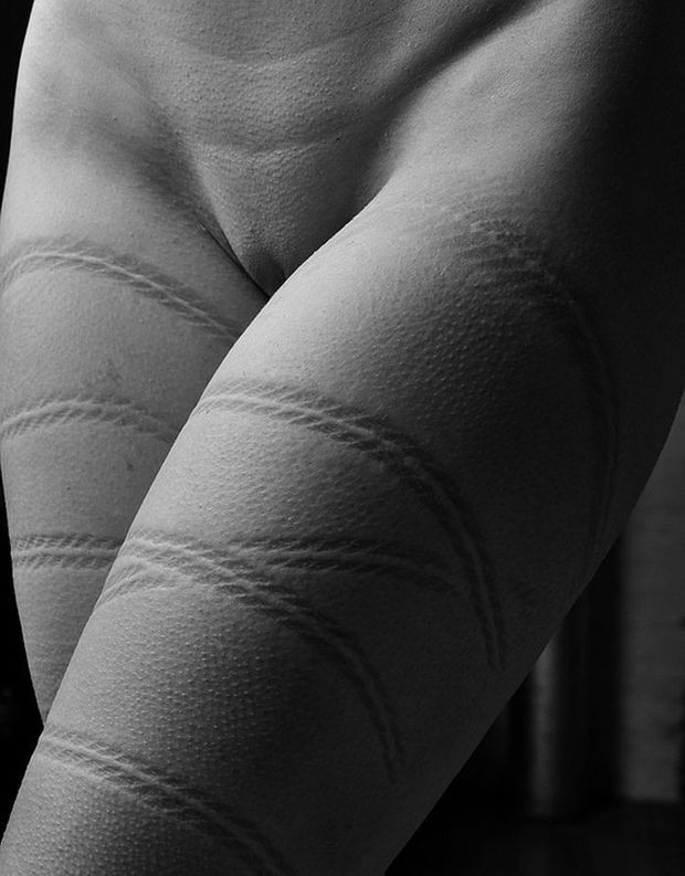 Skin marks