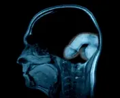 My brain on cock