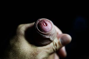 Lens of precum..