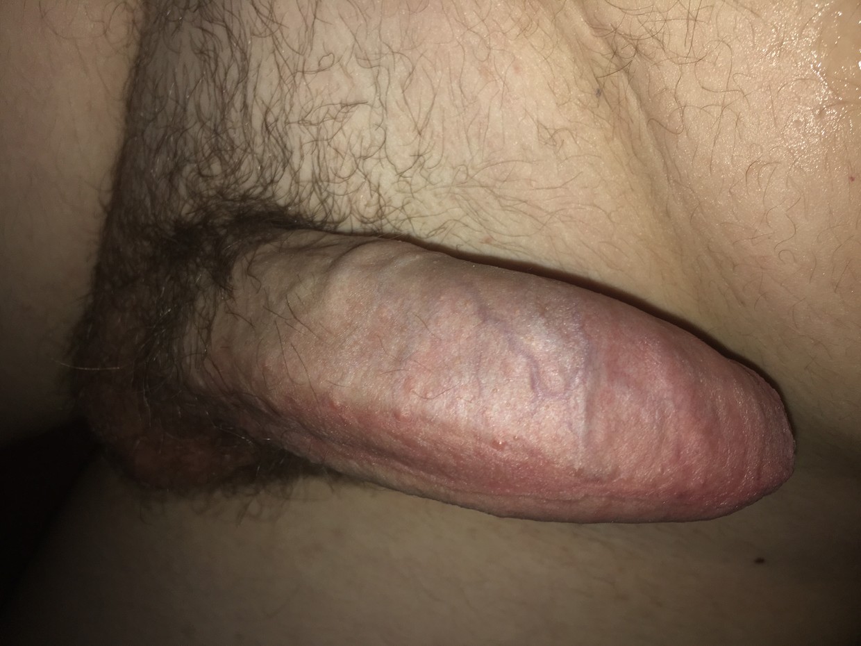Uncircumcised dick