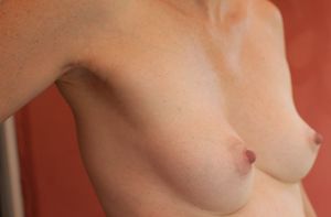 Mature 40 yo veiny tits and pink nipples #