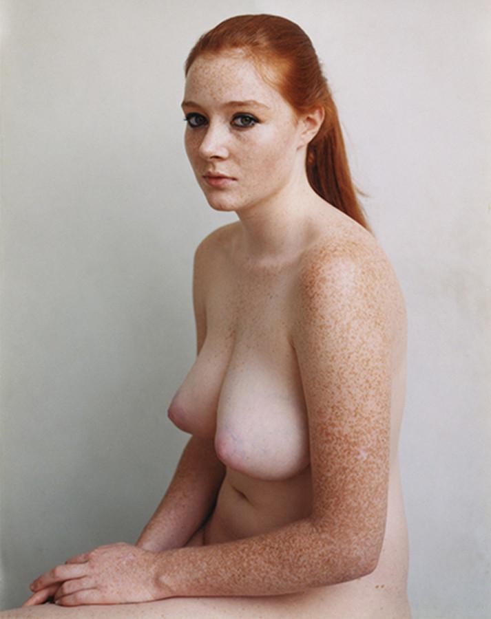 Freckle