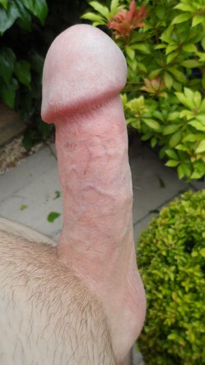 Mushroom head cock erect