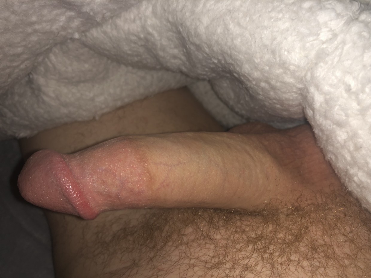Edging