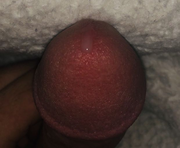 Edging leakage
