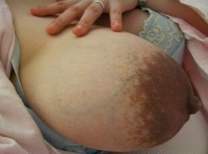 Look at the huge dark nipple