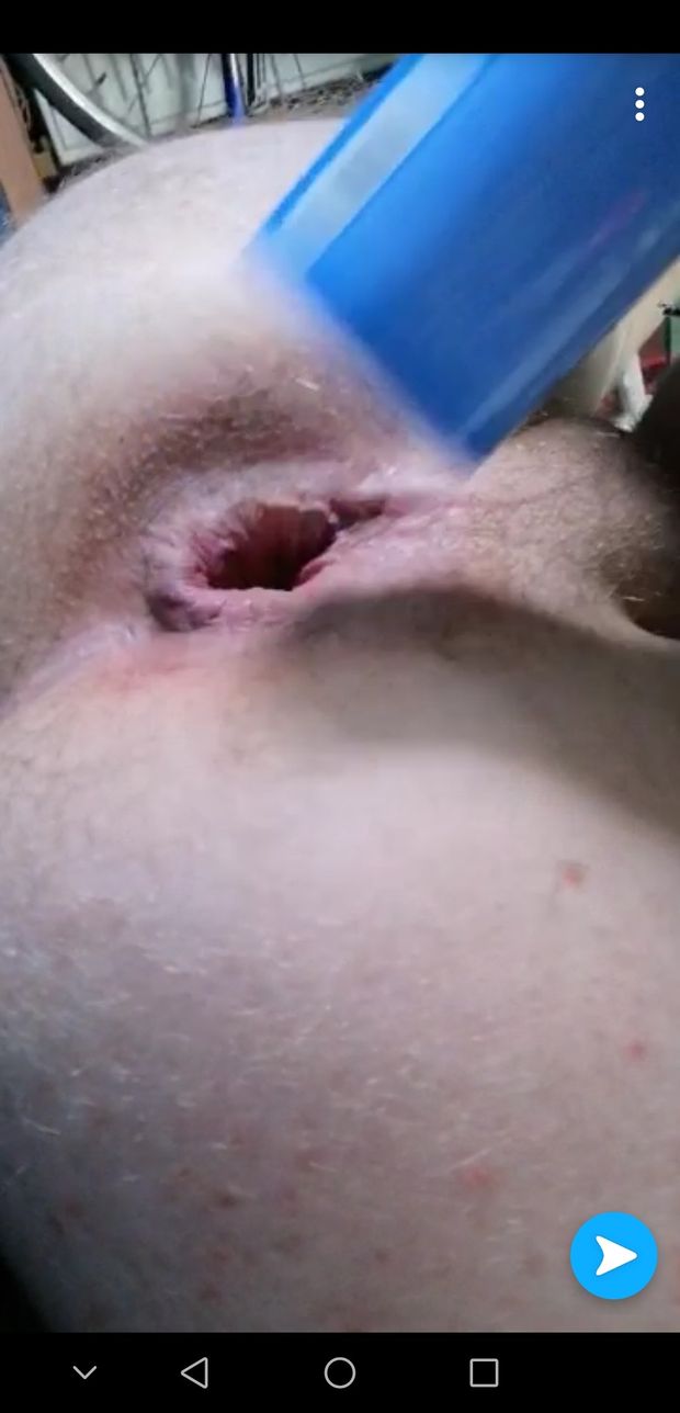 Anal play