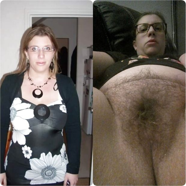 Hairy mature