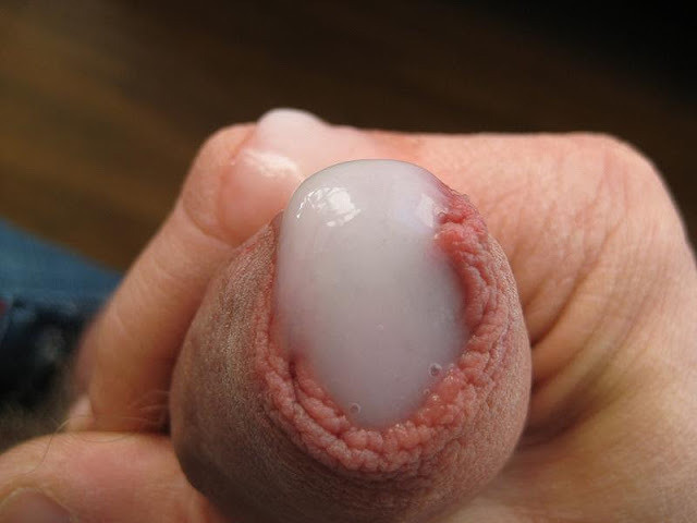 Collecting sperm..