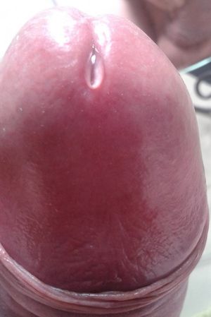 my other gay penis!!!`
