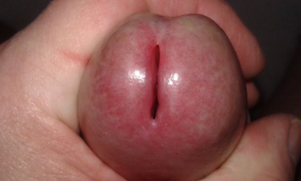 my other gay penis!!!`