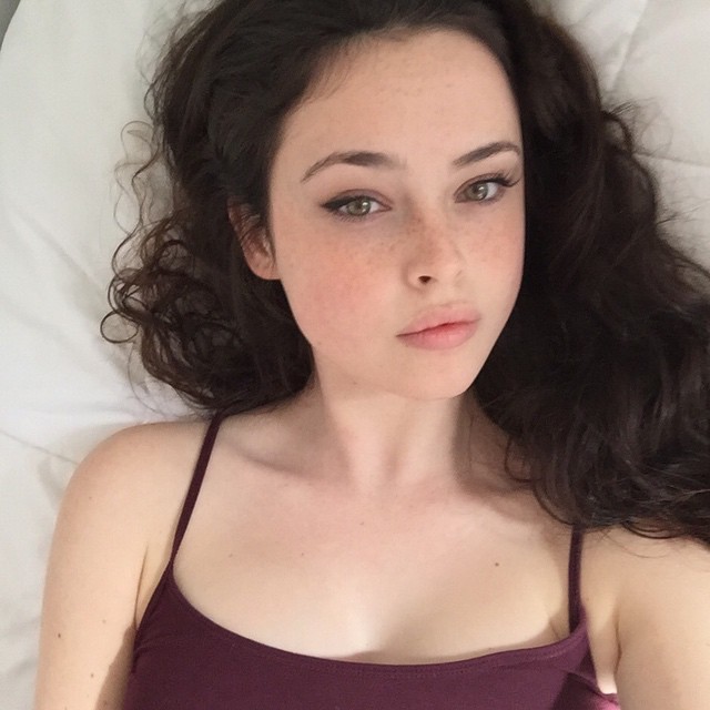 Freckles